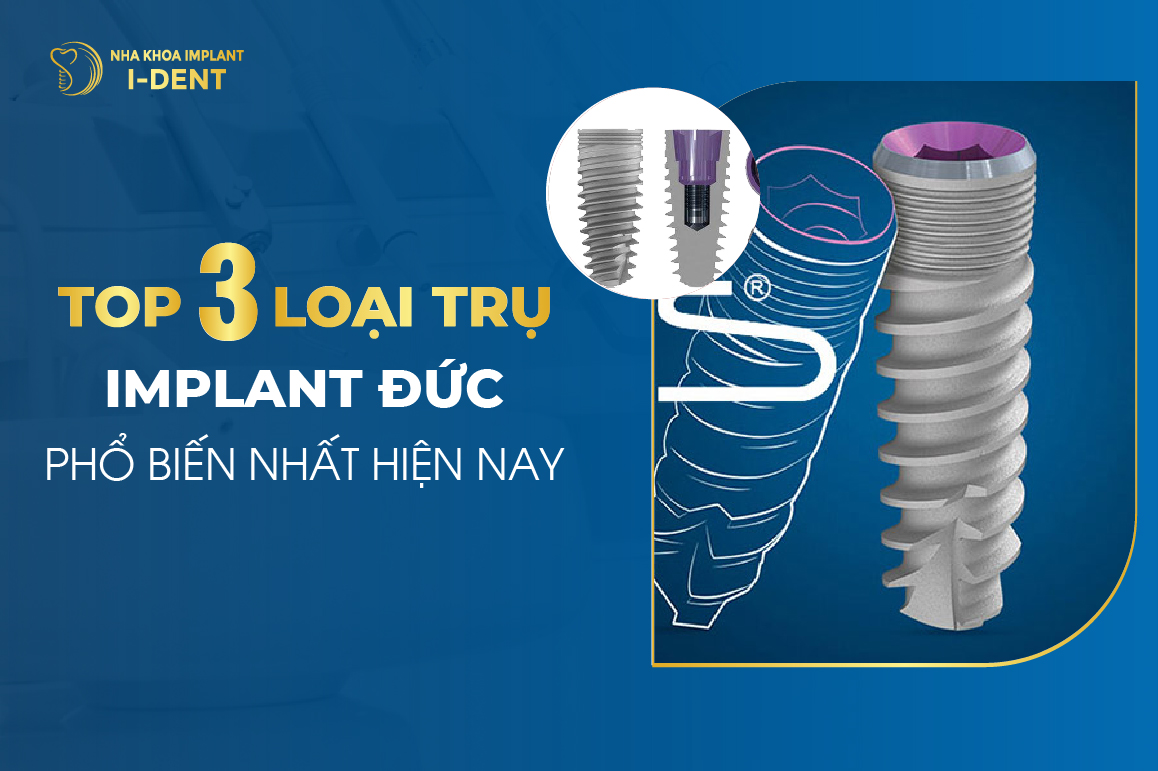 Top 3 Loai Tru Implant Duc Pho Bien Nhat Hien Nay 1