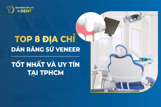 Top 8 Địa Chỉ Dán Răng Sứ Veneer Tốt Nhất Và Uy Tín Tại Tphcm