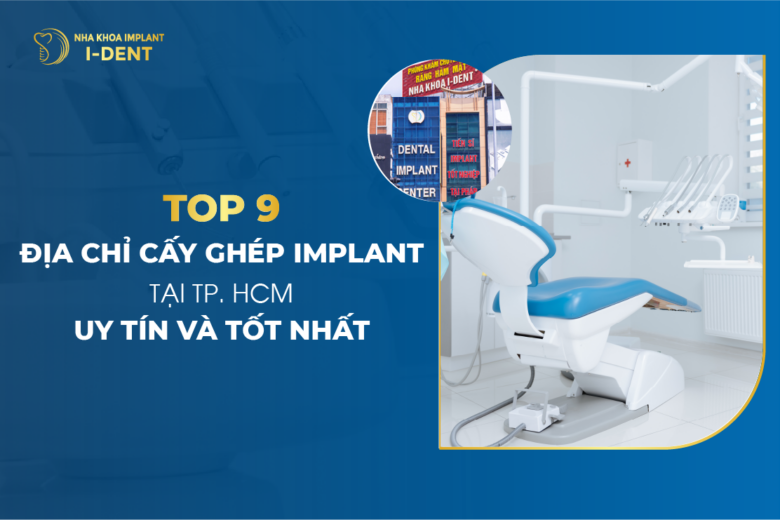 Trồng Răng Implant Ở Đâu? Top 9 Địa Chỉ Cấy Ghép Implant Tốt Tphcm
