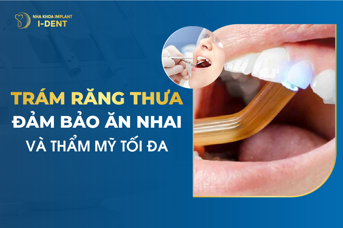 Tram Rang Thua Dam Bao An Nhai Va Tham My Toi Da