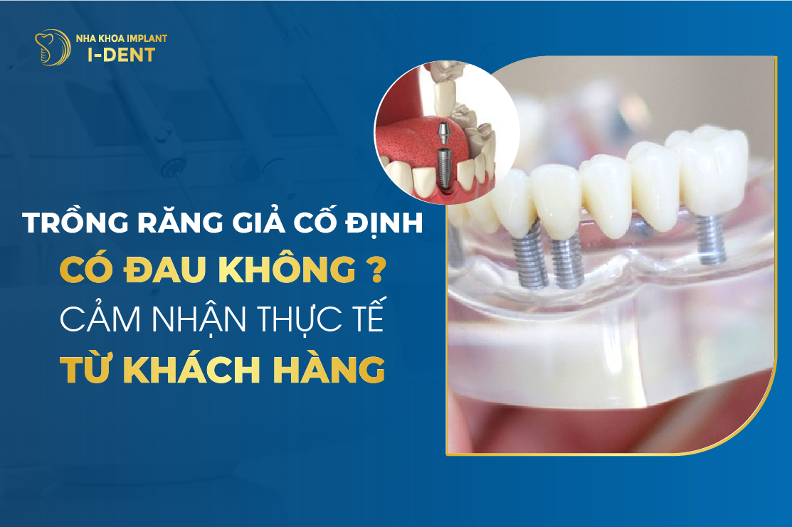 Trong Rang Gia Co Dinh Co Dau Khong Cam Nhan Thuc Te Tu Khach Hang