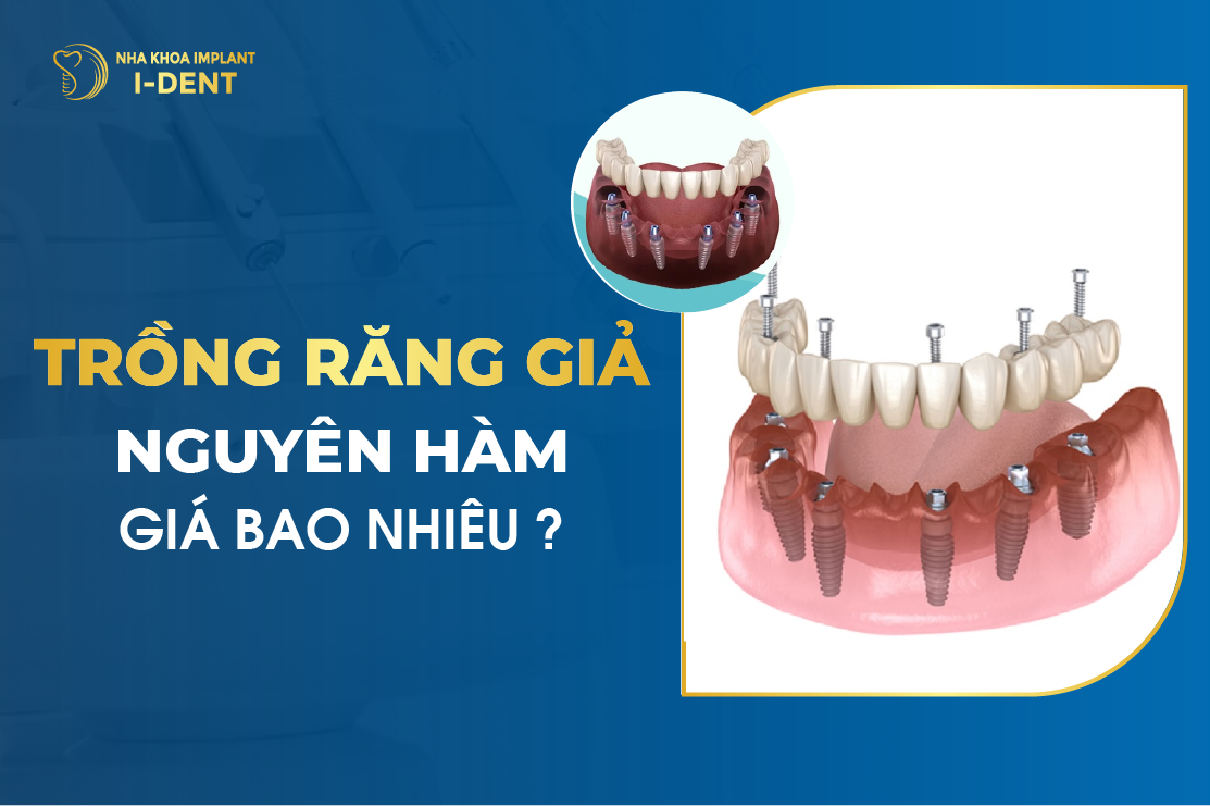 Trong Rang Gia Nguyen Ham Gia Bao Nhieu
