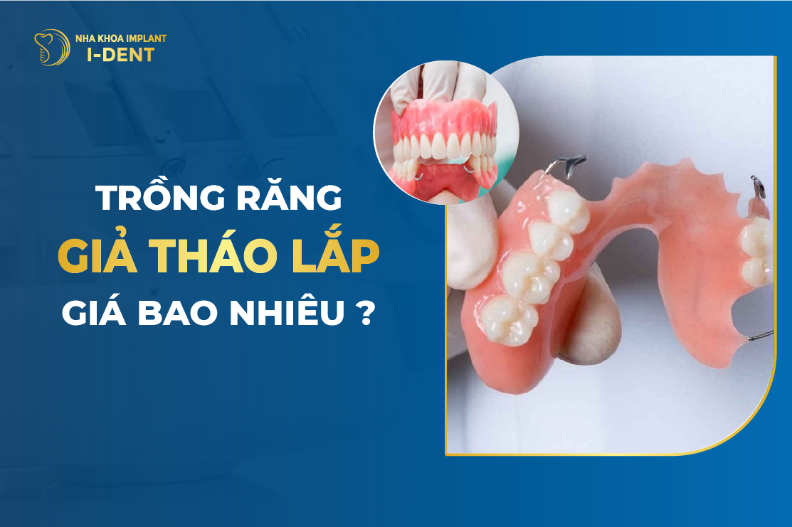 Trong Rang Gia Thao Lap Gia Bao Nhieu