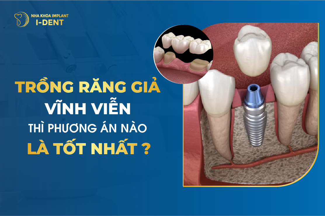 Trong Rang Gia Vinh Vien Thi Phuong Phap Nao La Tot Nhat