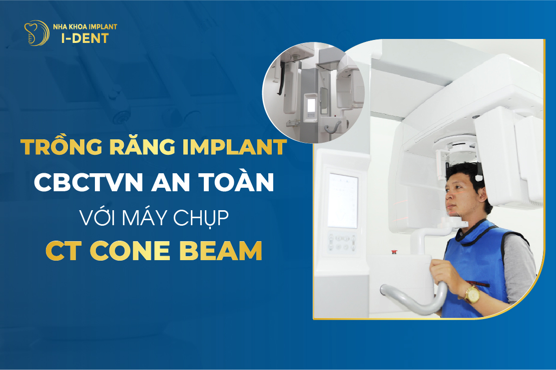 Trong Rang Implant Cbctvn An Toan Voi May Chup Ct Cone Beam