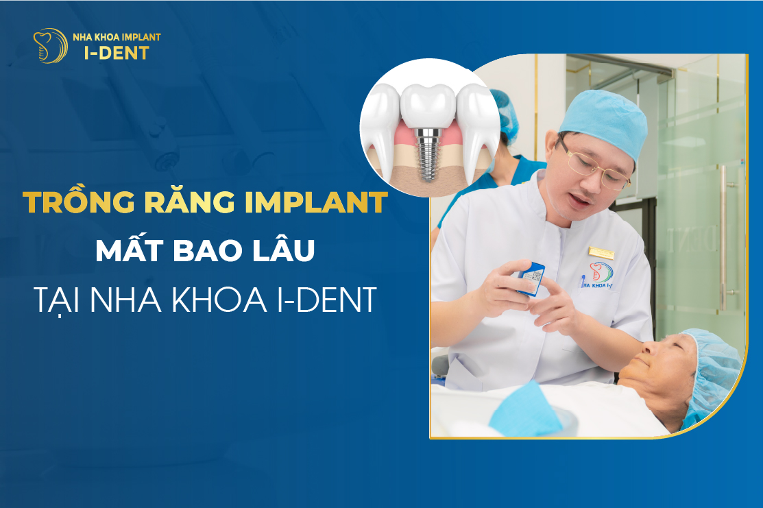 Trong Rang Implant Mat Bao Lau Tai Nha Khoa I Dent