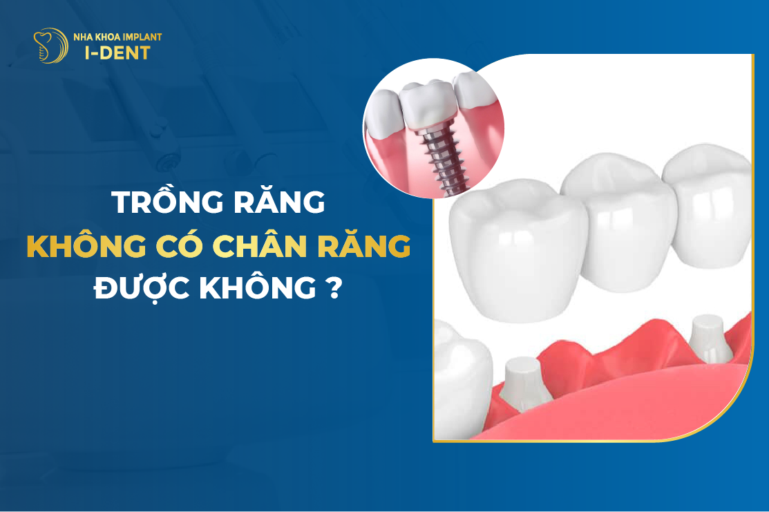 Trong Rang Khong Co Chan Rang Duoc Khong