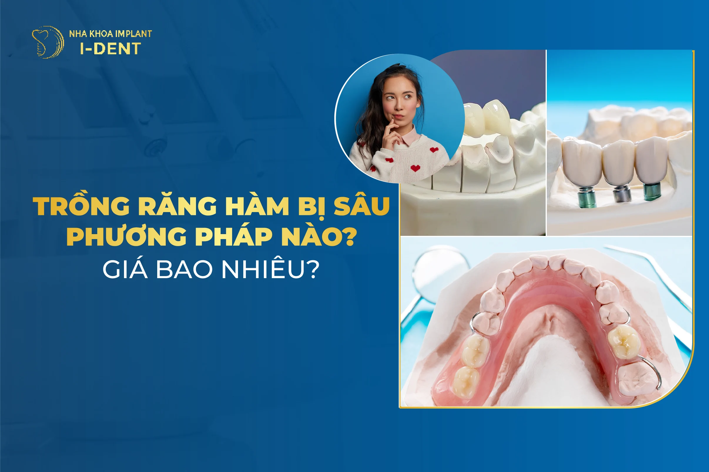Trong Rang Ham Bi Sau Phuong Phap Nao Gia Bao Nhieu