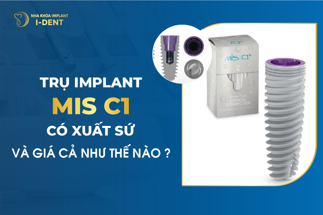 Tru Implant Mis Co Xuat Xu Va Gia Ca Nhu The Nao