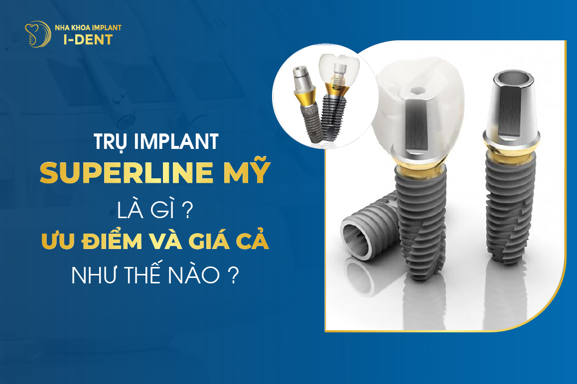 Tru Implant Superline My La Gi Uu Diem Va Gia Ca Nhu The Nao 1