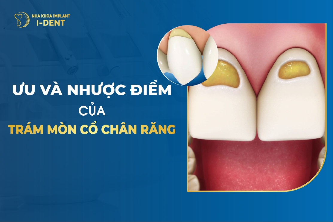 Uu Va Nhuoc Diem Cua Tram Mon Co Chan Rang