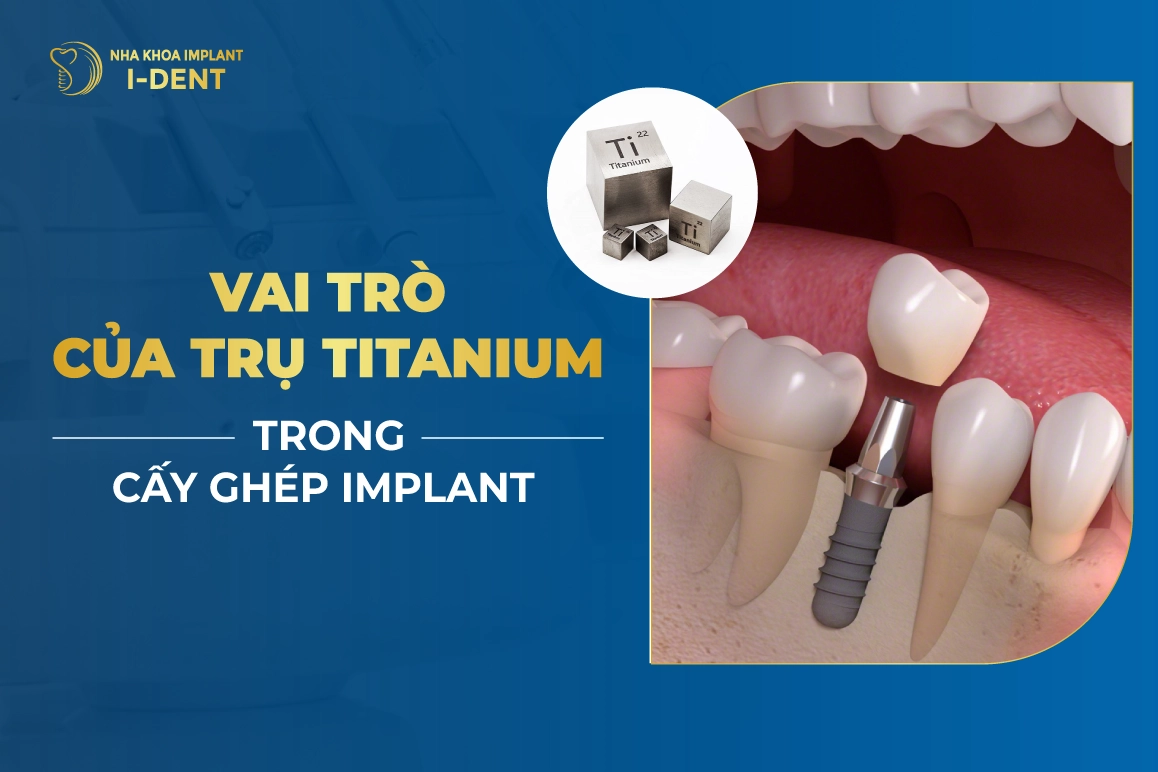 Vai Tro Cua Tru Titanium Trong Cay Ghep Implant