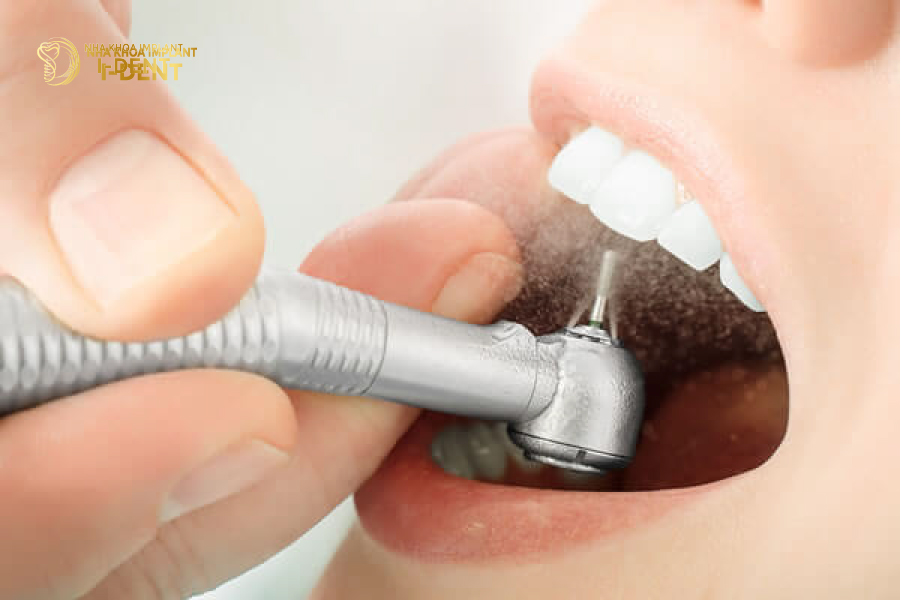 tháo răng sứ làm lại