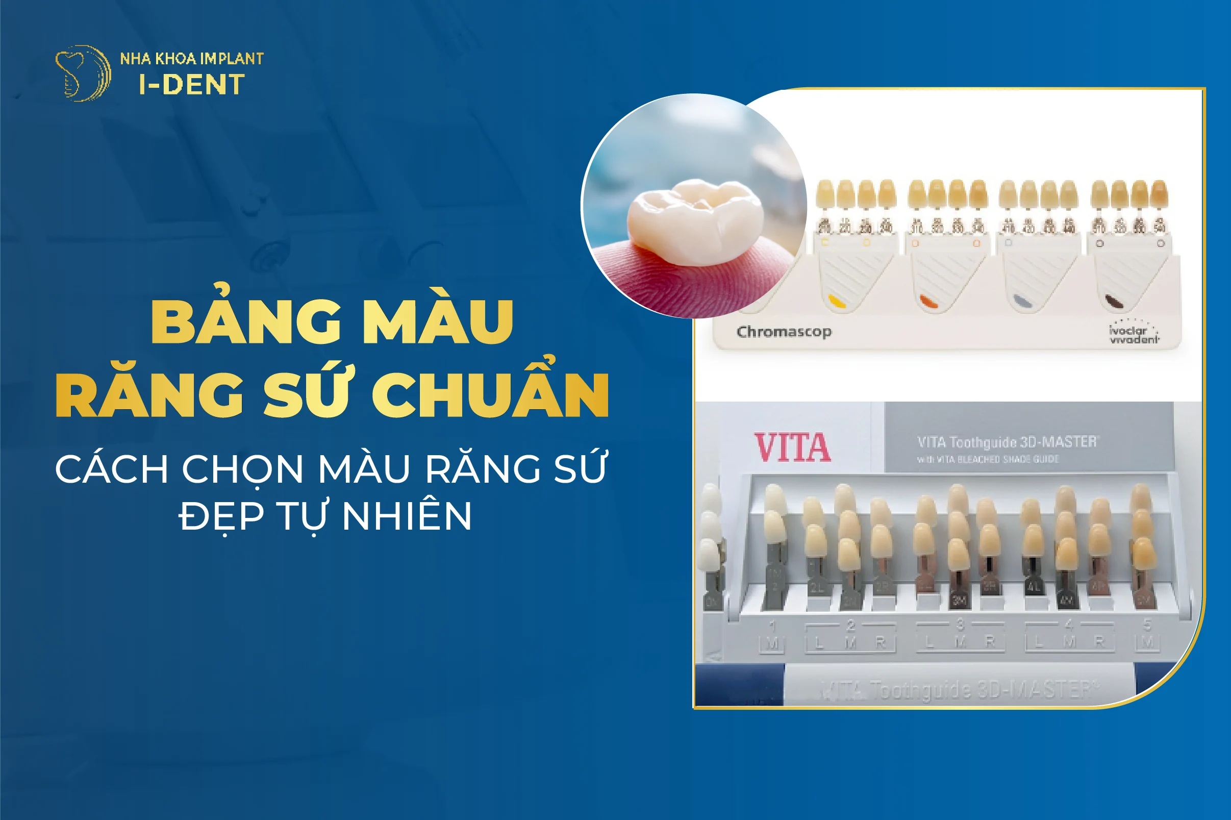 Bang Mau Rang Su Chuan Hien Nay Cach Chon Mau Rang Su Dep