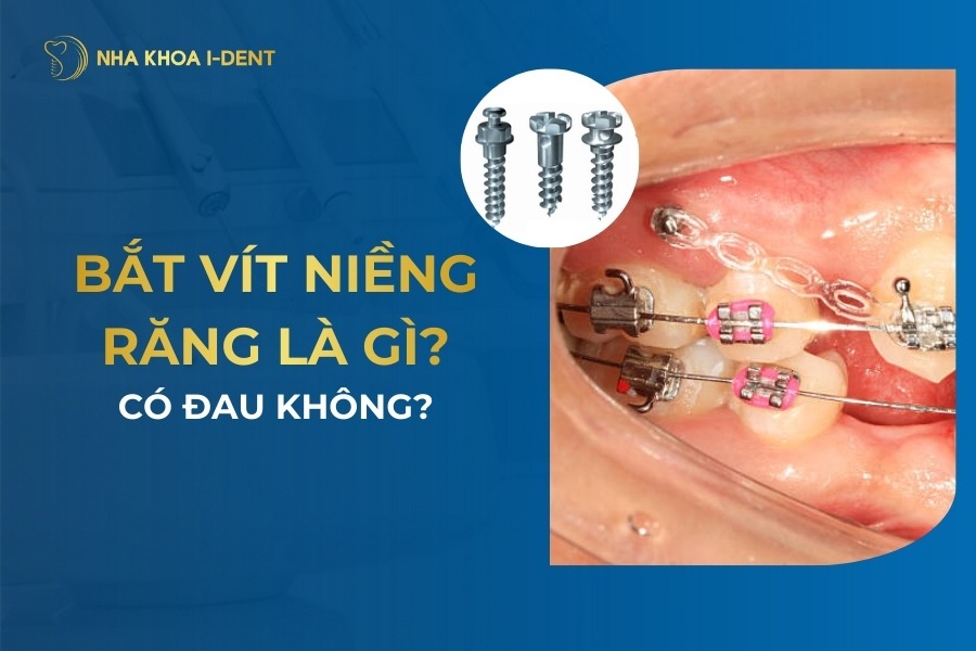 Bat Vit Nieng Rang