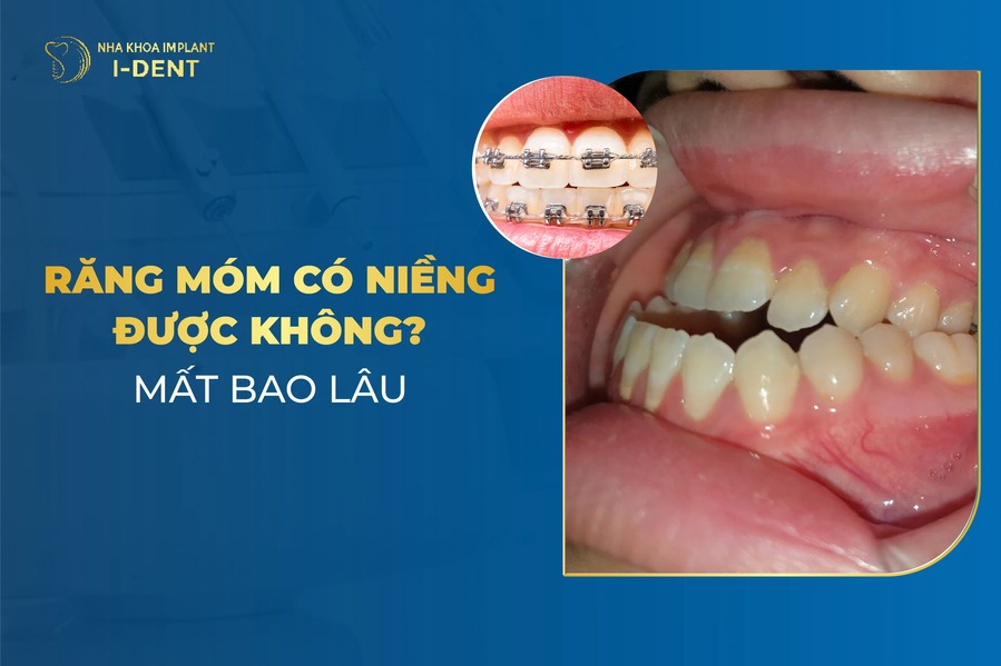 Bi Mom Co Nieng Rang Duoc Khong
