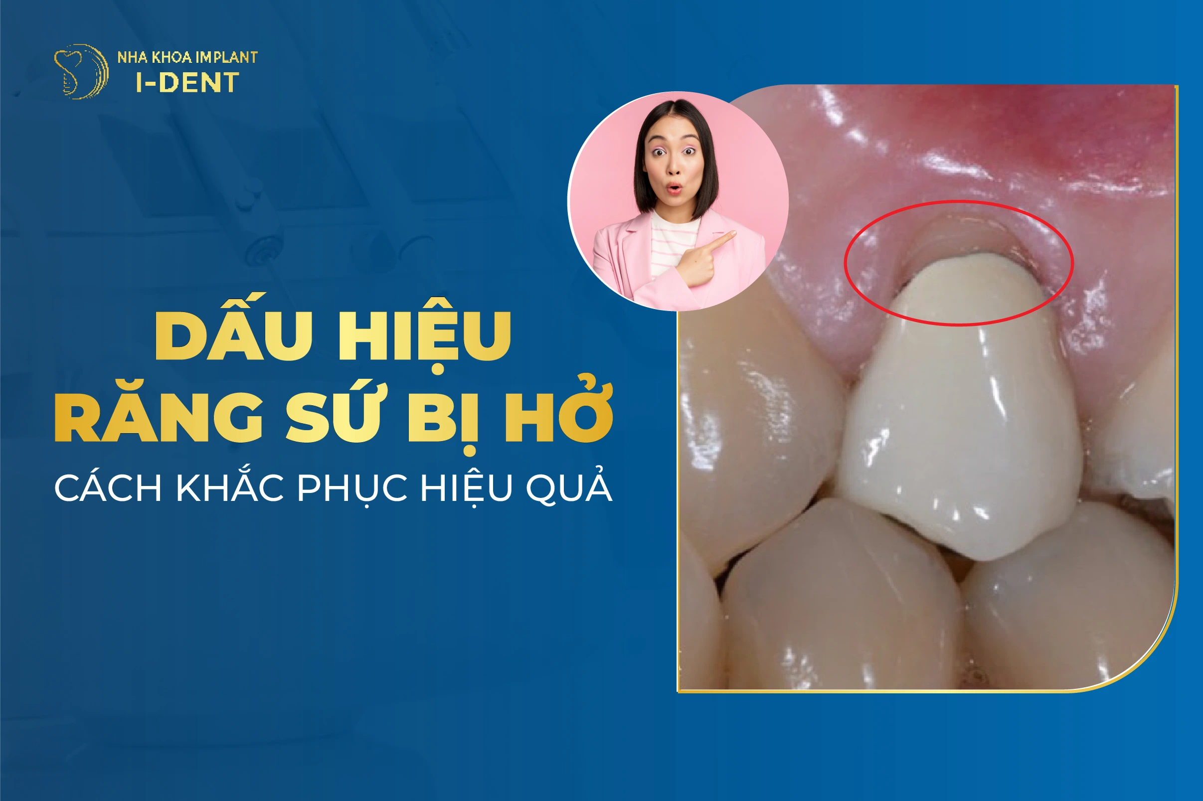Boc Rang Su Bi Ho Loi