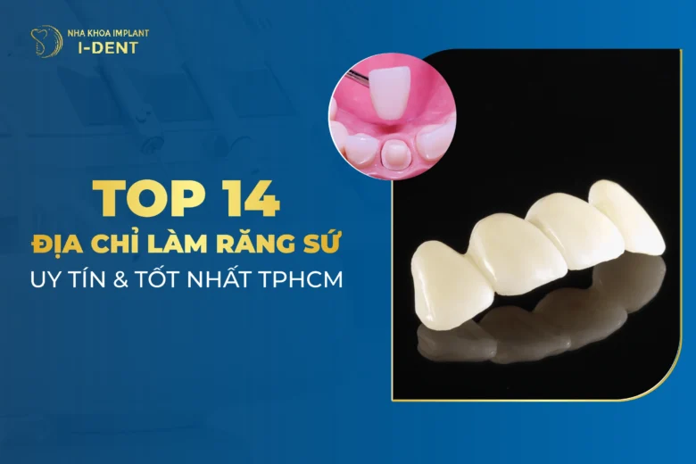 Top 14 Địa Chỉ Làm Răng Sứ Uy Tín Nhất Tphcm