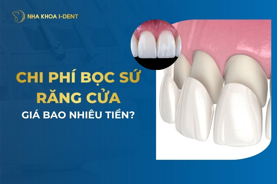 Boc Su Rang Cua Gia Bao Nhieu