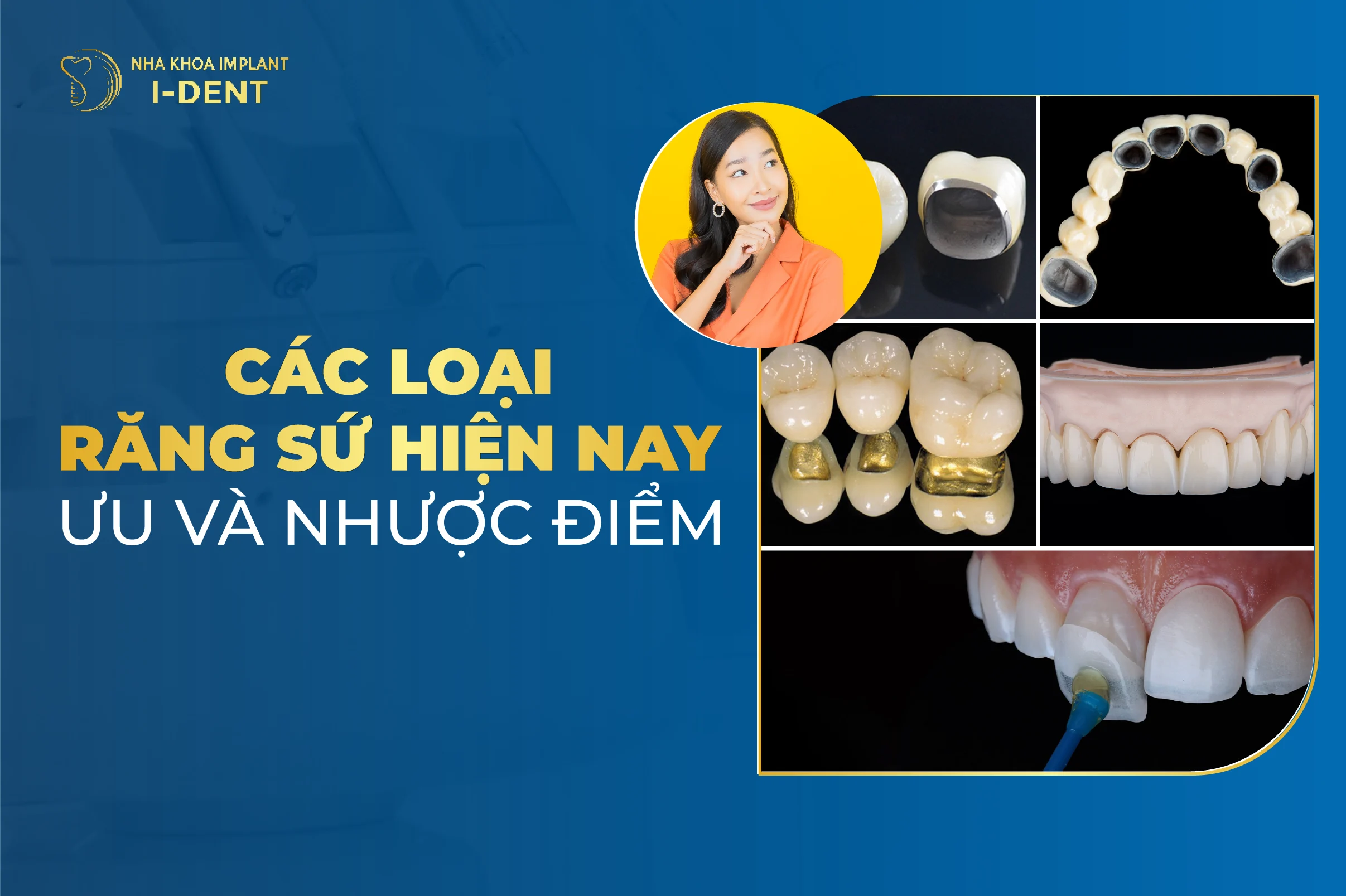 Cac Loai Rang Su Hien Nay