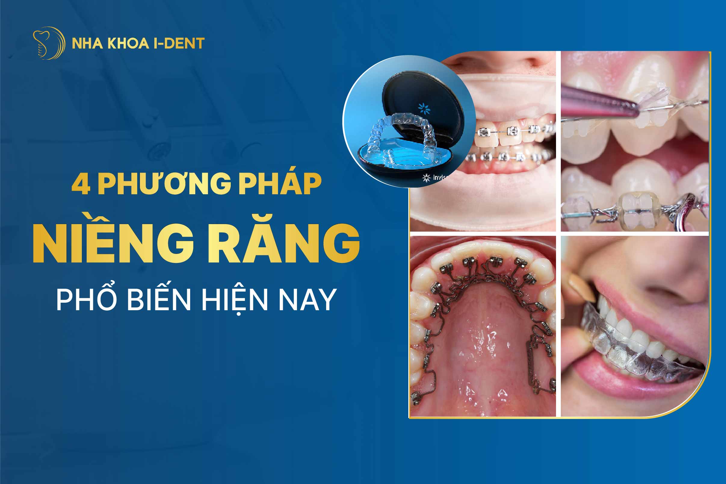 Cac Phuong Phap Nieng Rang Pho Bien