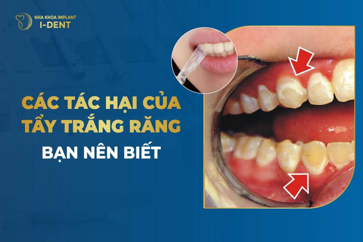 Cac Tac Hai Cua Tay Trang Rang Ban Nen Biet