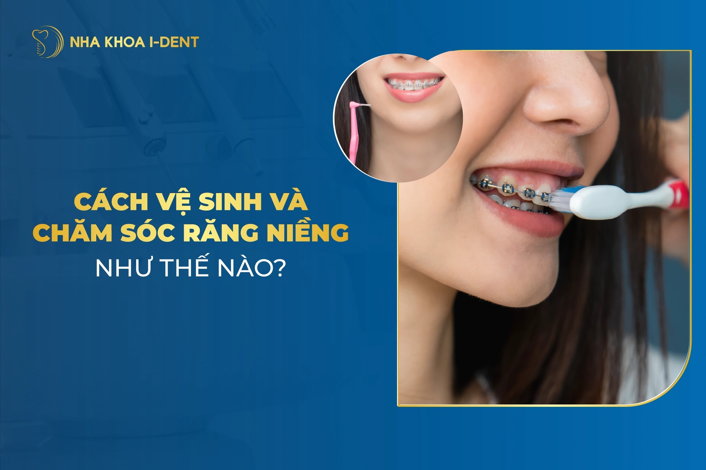 Cach Cham Soc Rang Mieng Khi Nieng Rang