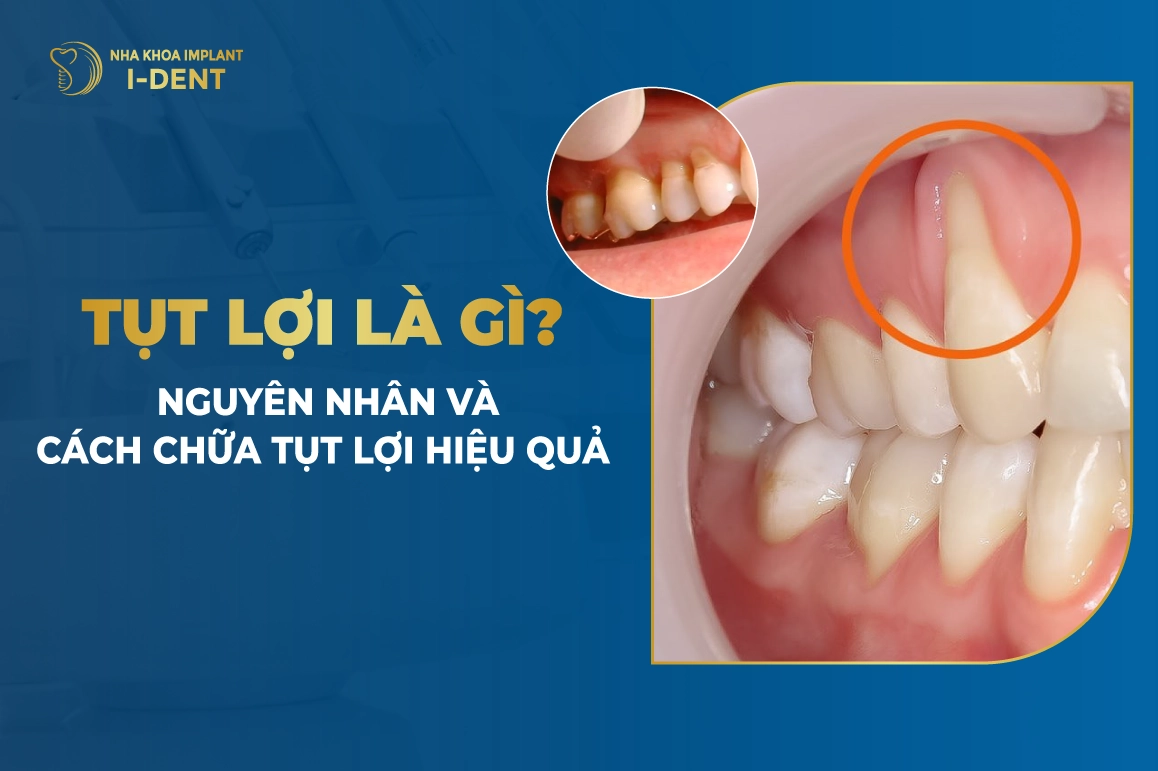 Cach Chua Tut Loi Hieu Qua