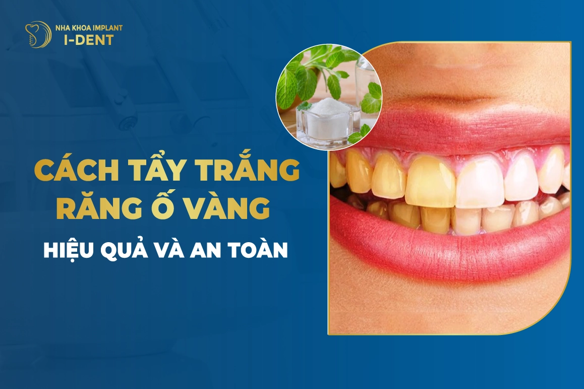 Cach Tay Trang Rang O Vang Hieu Qua Va An Toan