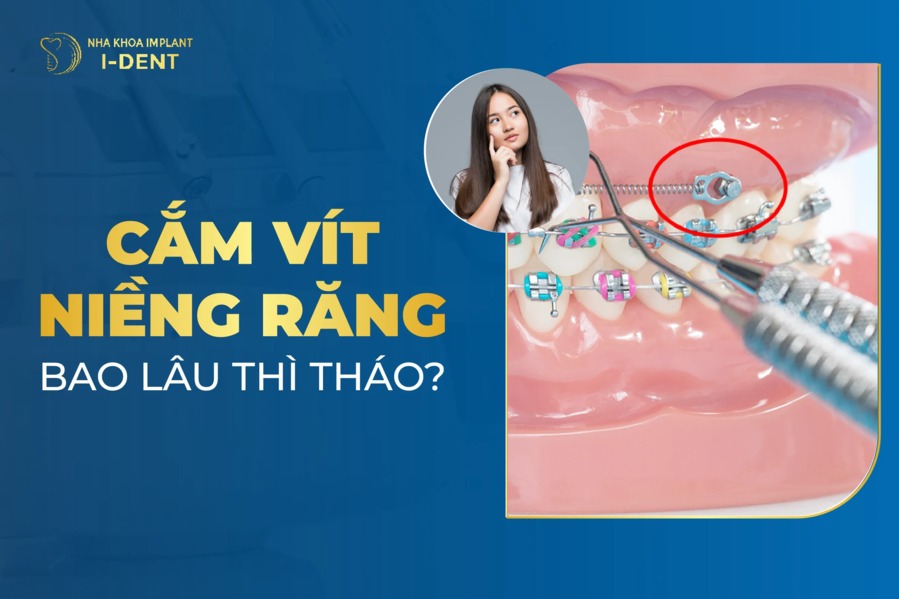 Cam Vit Nieng Rang Bao Lau