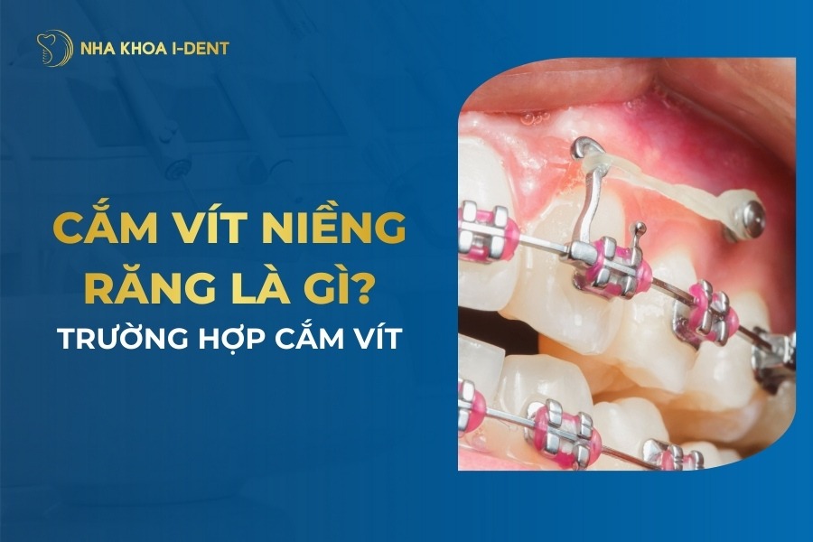 Cam Vit Nieng Rang