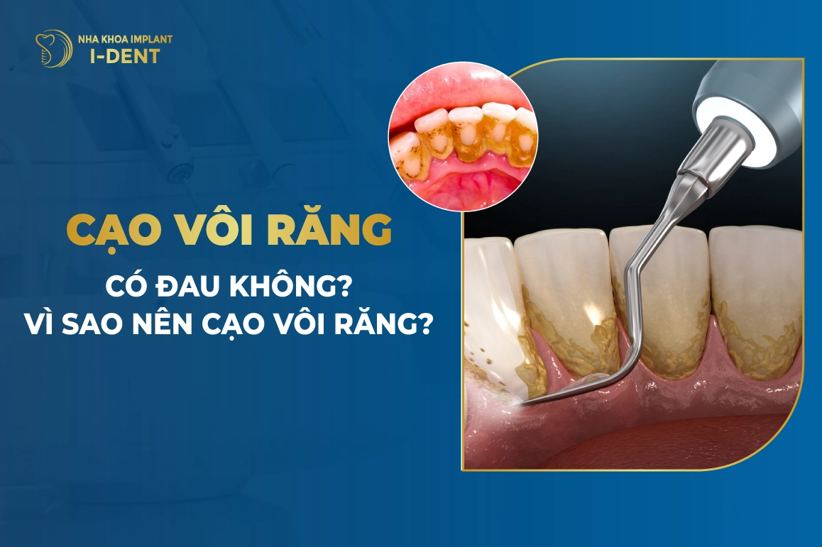 Cao Voi Rang Co Dau Khong