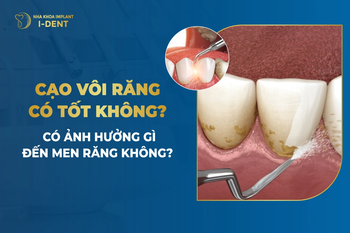 Cao Voi Rang Co Tot Khong
