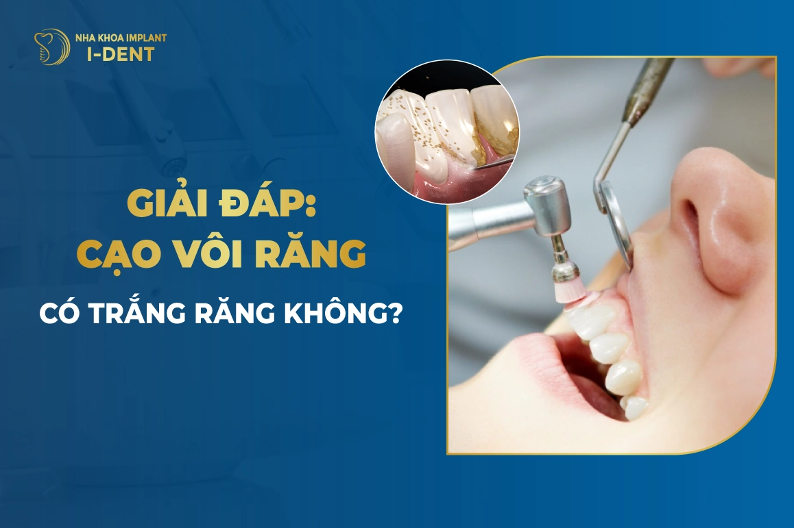 Cao Voi Rang Co Trang Rang Khong