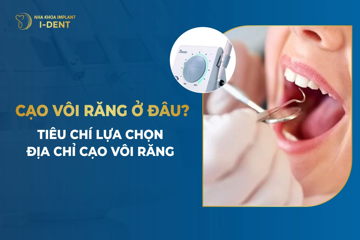 Cao Voi Rang O Dau