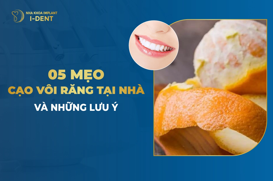 Cao Voi Rang Tai Nha Va Nhung Luu Y