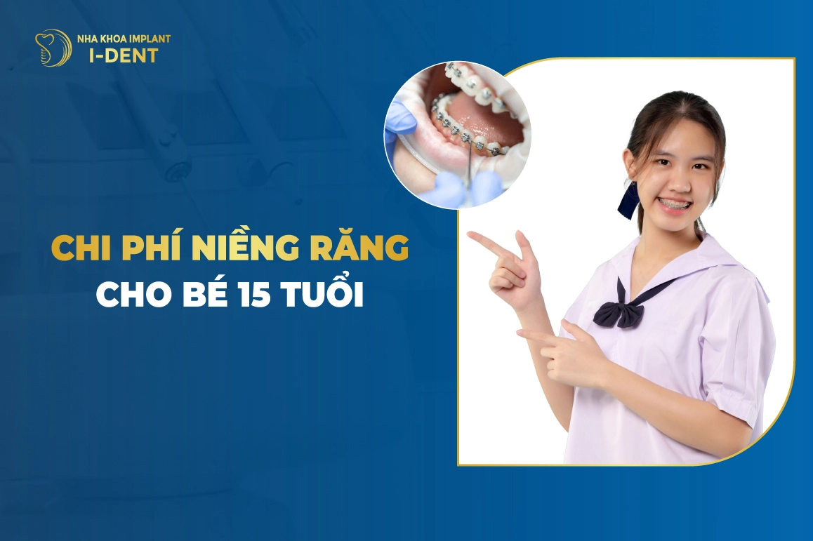 Chi Phi Nieng Rang Cho Be 15 Tuoi