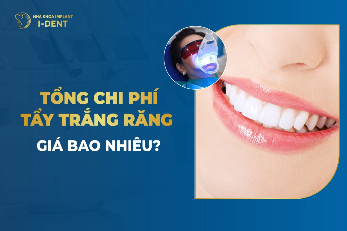 Chi Phi Tay Trang Rang Bao Nhieu Tien