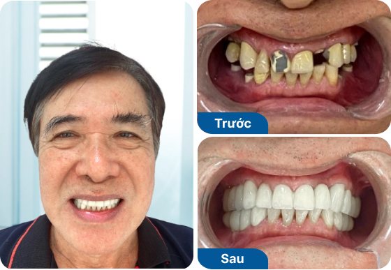 Mr. Van Vinh