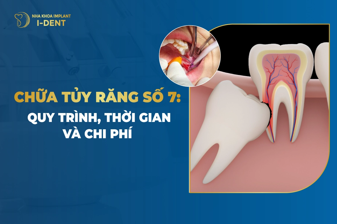 Chua Tuy Rang So 7 Quy Trinh Thoi Gian Chi Phi