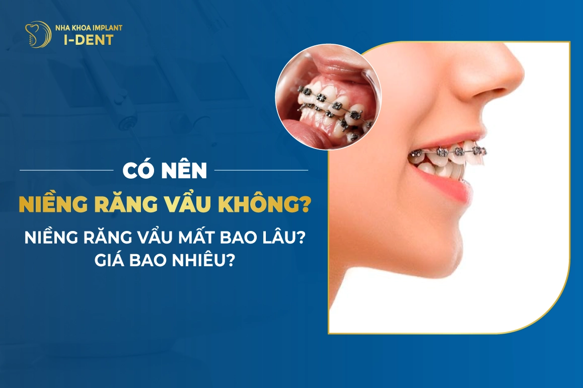 Co Nen Nieng Rang Vau Khong Nieng Rang Vau Mat Bao Lau