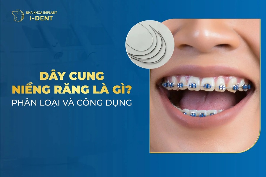 Day Cung Nieng Rang