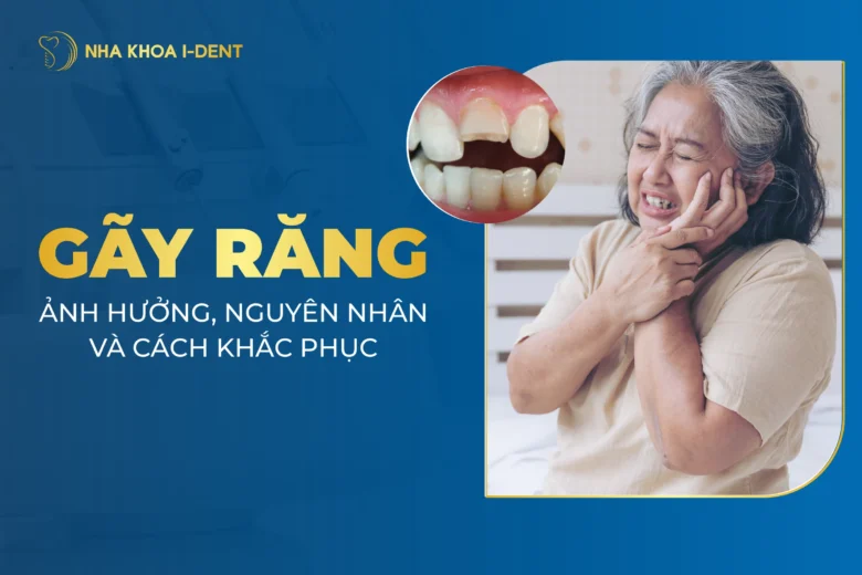 Gãy Răng: Ảnh Hưởng, Nguyên Nhân Và Cách Xử Lý
