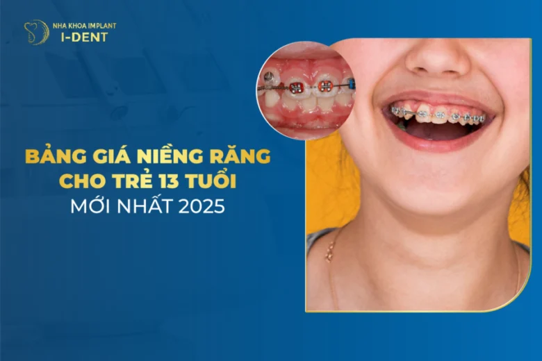 Chi Phí Niềng Răng Cho Trẻ 13 Tuổi Hết Bao Nhiêu Tiền?