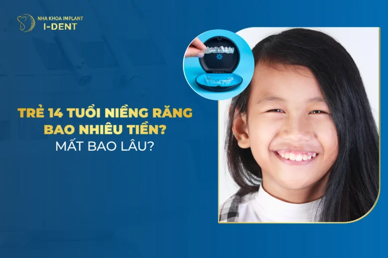 Trẻ 14 Tuổi Niềng Răng Bao Nhiêu Tiền? Bảng Giá Chi Tiết 2026