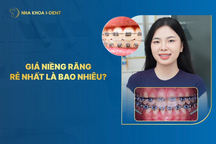 Gia Nieng Rang Re Nhat