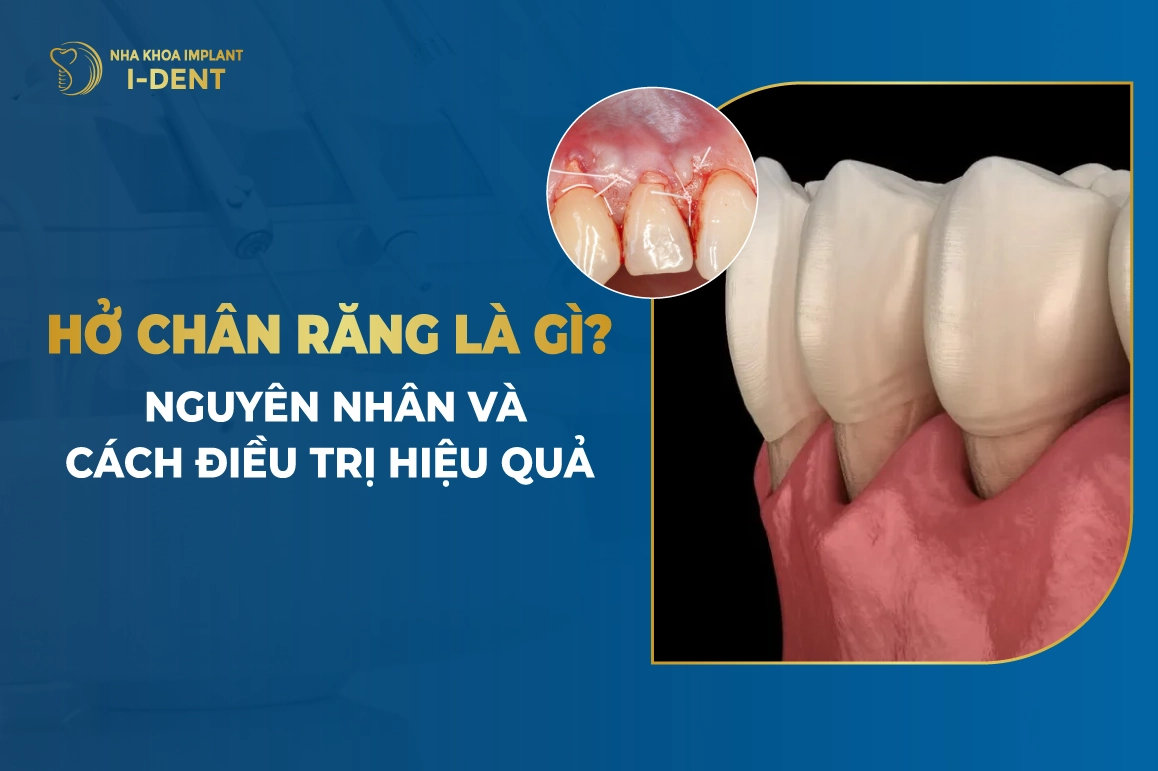Ho Chan Rang La Gi