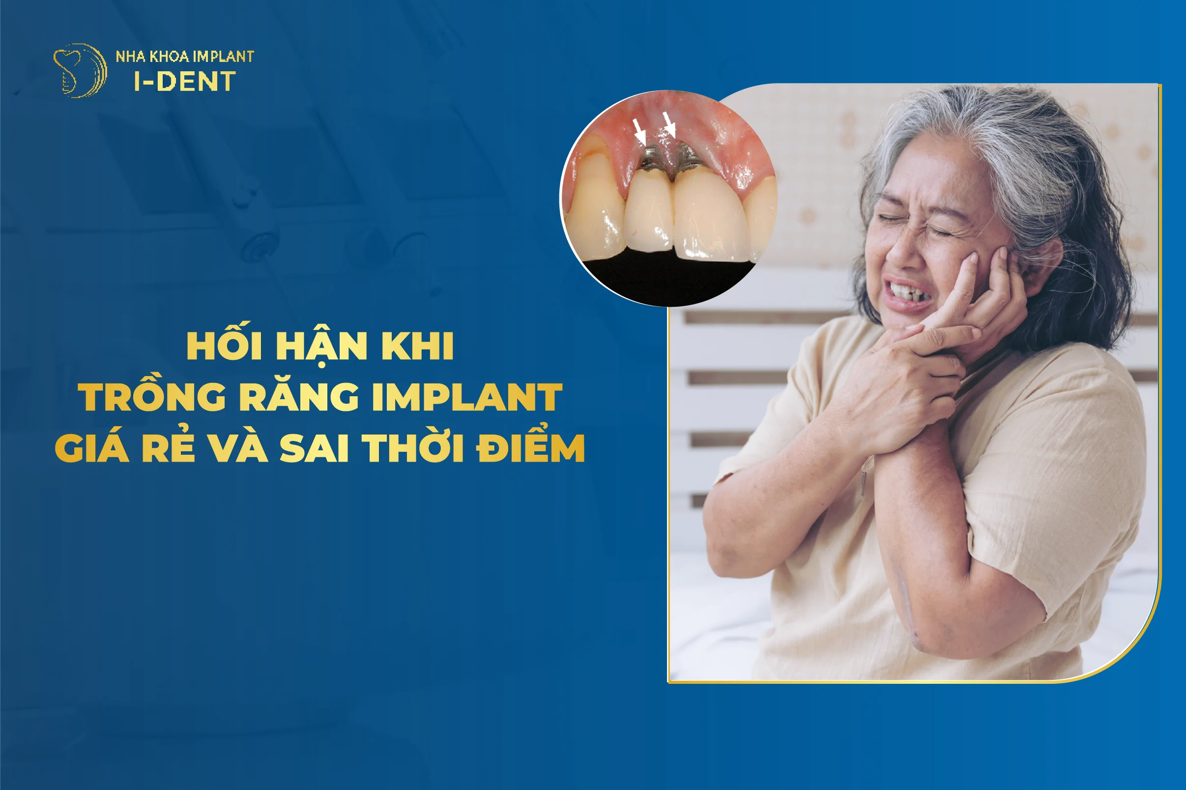 Hoi Han Khi Trong Rang Implant
