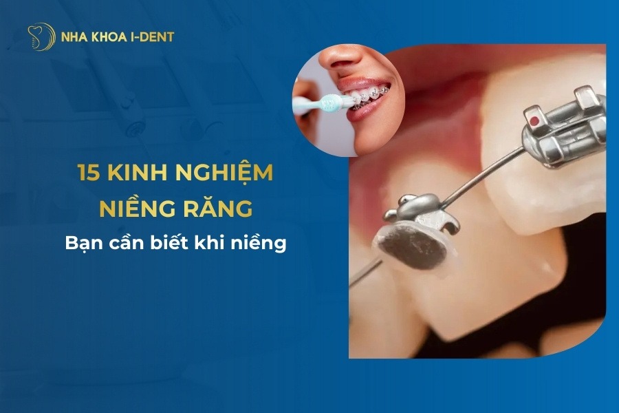 Kinh Nghiem Nieng Rang