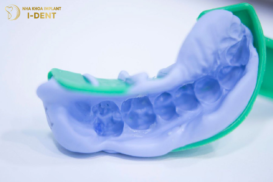 lấy implant